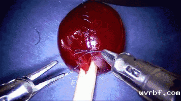 1594102192127542.gif https://mmbiz.qpic.cn/mmbiz_gif/LJiau2qPWAcUxpQbwYotc2mvZ6Es0uyepJLzolfxEHvxzoLATKaGyvuHfSOPu57IZSpUYxE58a6TsmDuI6HgVLw/640?wx_fmt=gif&wxfrom=5&wx_lazy=1